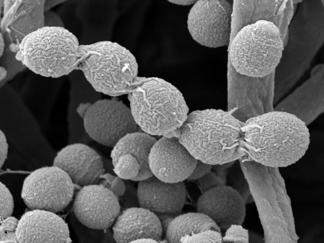 Penicillin spores imaged by EM